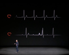 Apple Just Received a Fast Lane for Developing Health Features