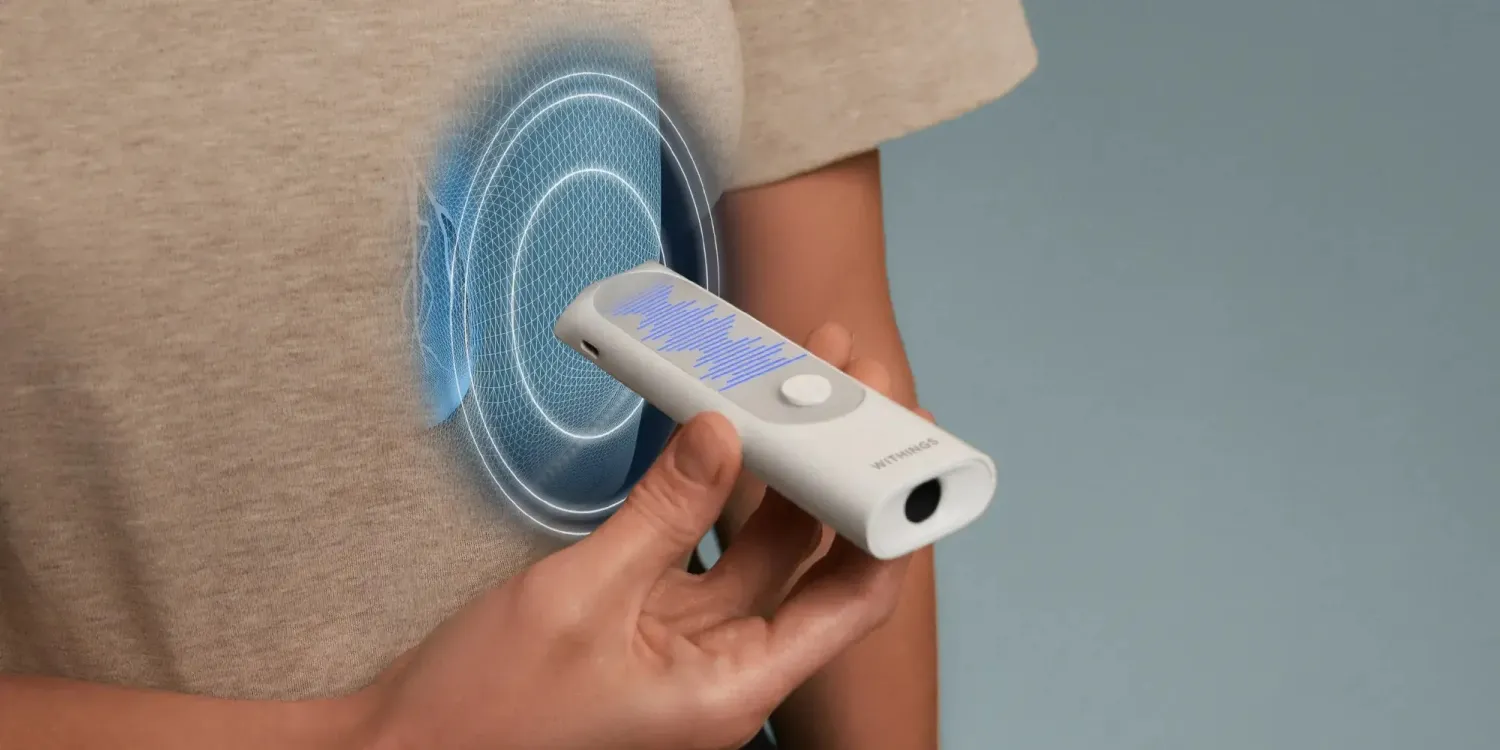 Withings Unveils BeamO 4-in-1 ‘Disruptive’ Multiscope with Apple Health Support