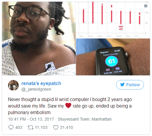 Apple Watch Notification Helps Save Man's life: 'It Would have Been Fatal' 