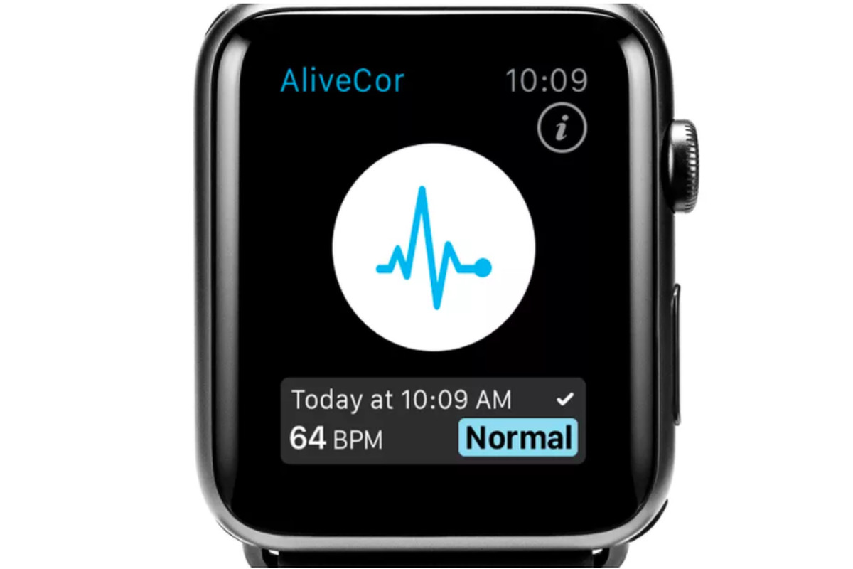 Apple Watch Wristband Sensor Claims to Detect Potassium in Your Blood — without Needles