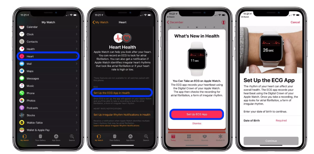 How to Take an ECG (electrocardiogram) on Apple Watch