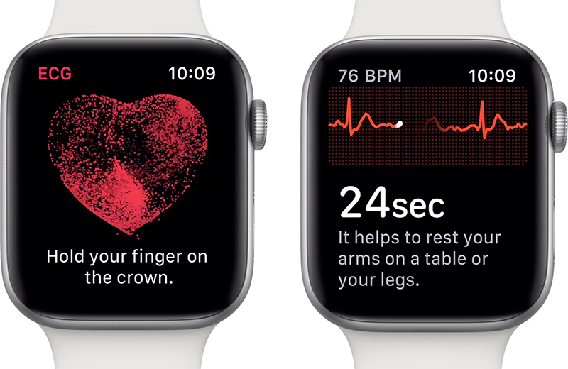 Apple Watch ECG is Coming to Canada 'as Quickly as Possible'