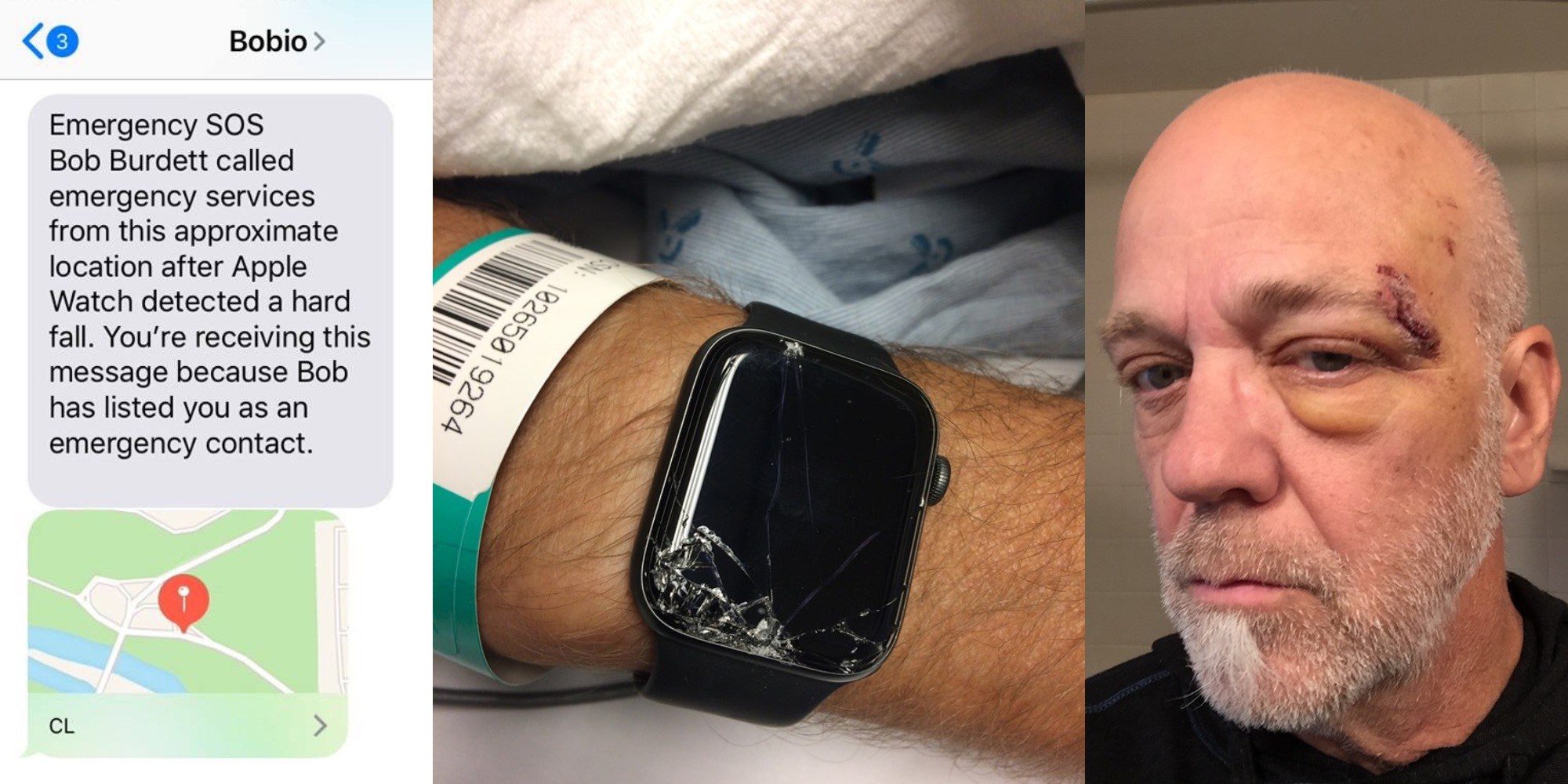 Apple Watch Helps locate Mountain Biker After Unexpected Fall